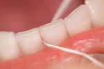 flossing_01